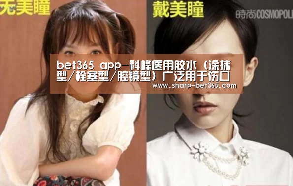 bet365 app-科峰医用胶水（涂抹型/栓塞型/腔镜型）广泛用于伤口缝合(图1)